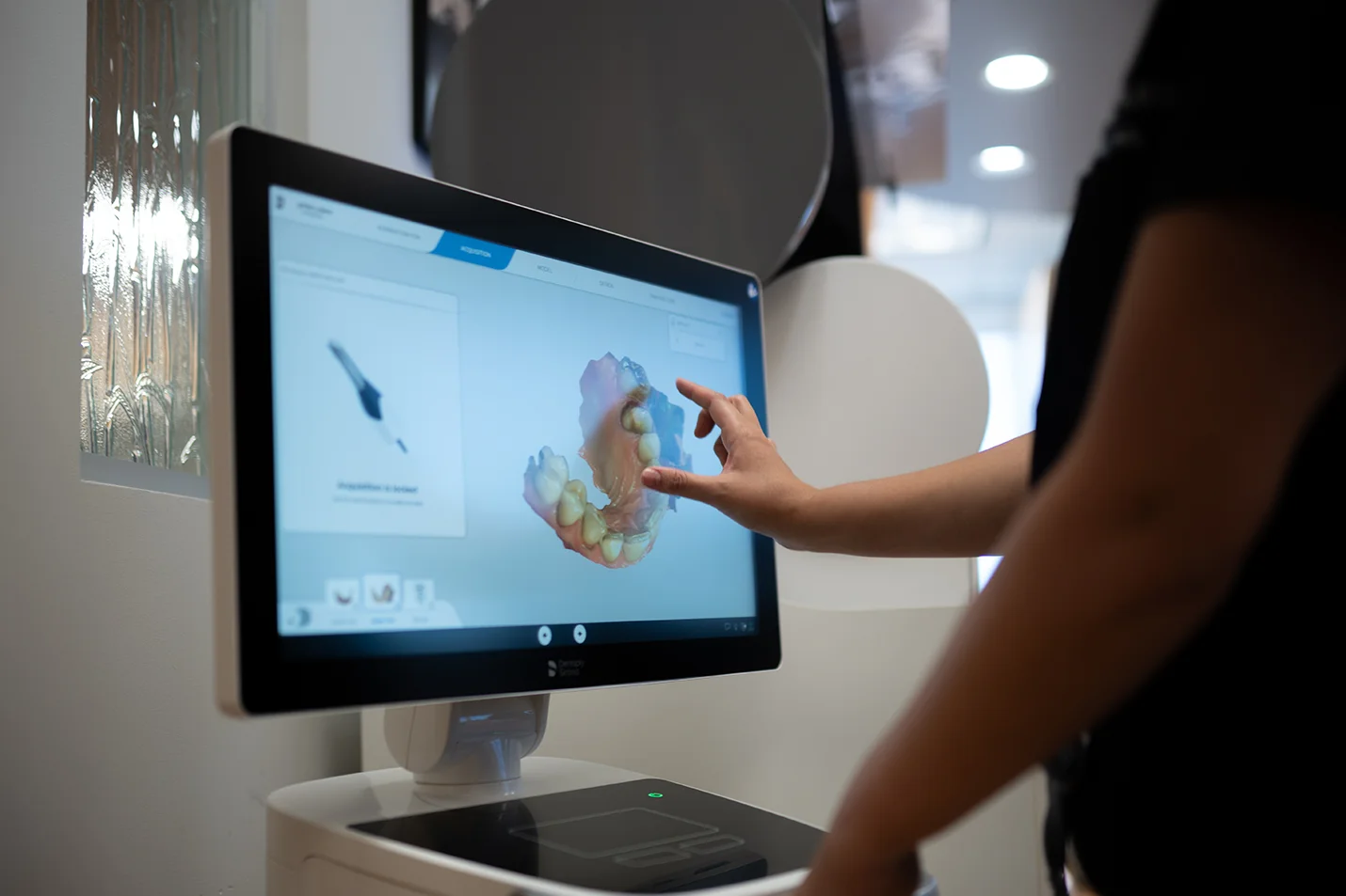 Hand interacting with a digital 3D dental scan on a touchscreen at Best Natural Smile