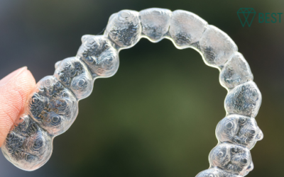 Am I a Candidate for Invisalign?