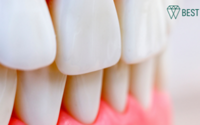 Oral Microbiome: How It Affects Your Overall Health
